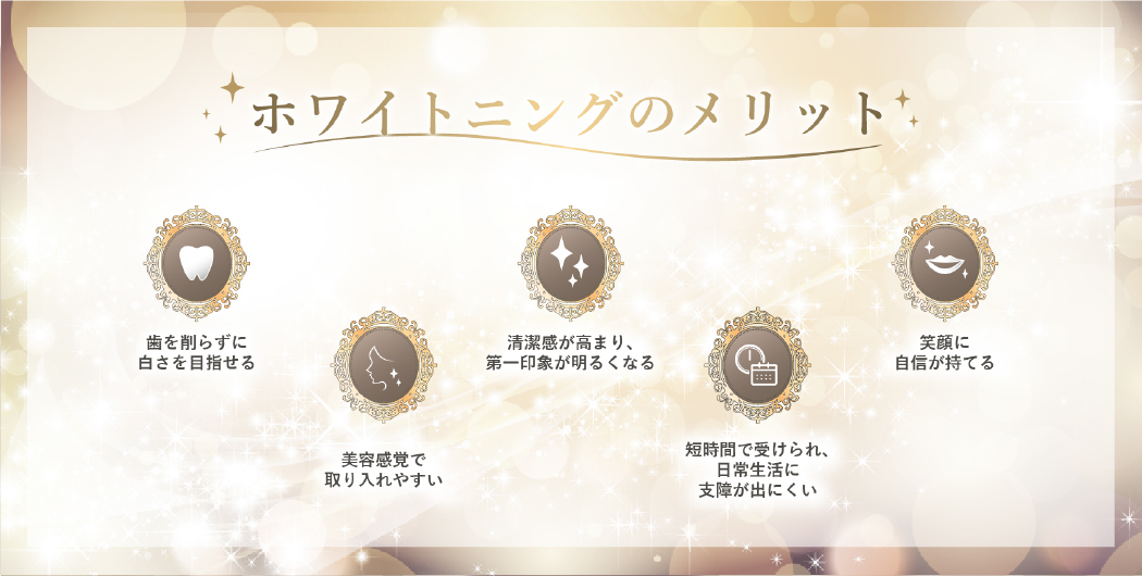 ホワイトニングのメリット:歯を削らずに白さを目指せる/美容感覚で取り入れやすい/清潔感が高まり、第一印象が明るくなる/短時間で受けられ、日常生活に支障が出にくい/笑顔に自信が持てる